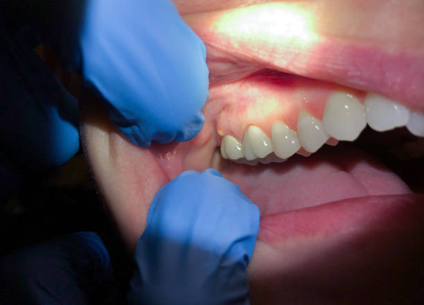 Best Mobile Emergency Dentist in Krebs, OK